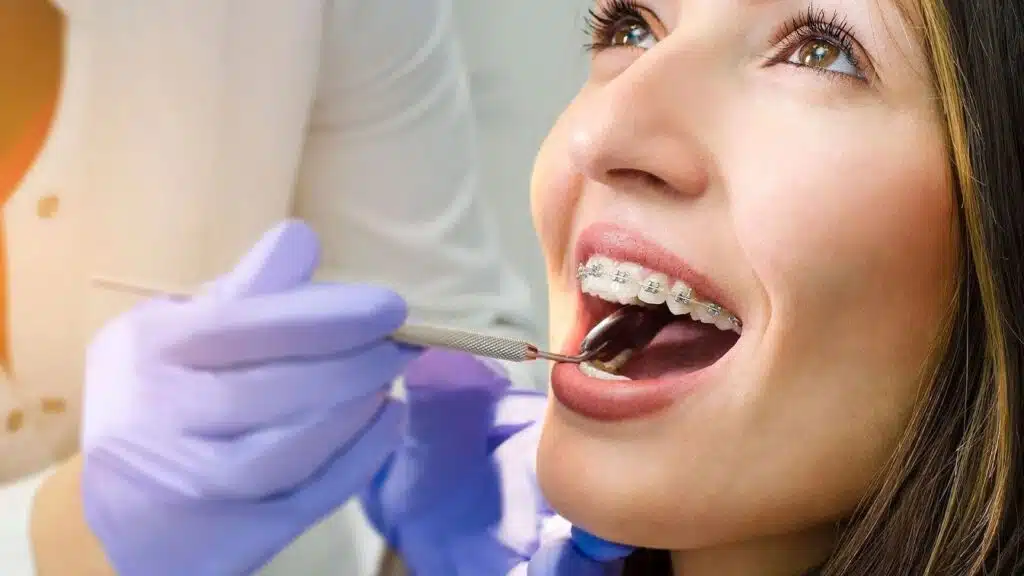 how spacers work in orthodontics